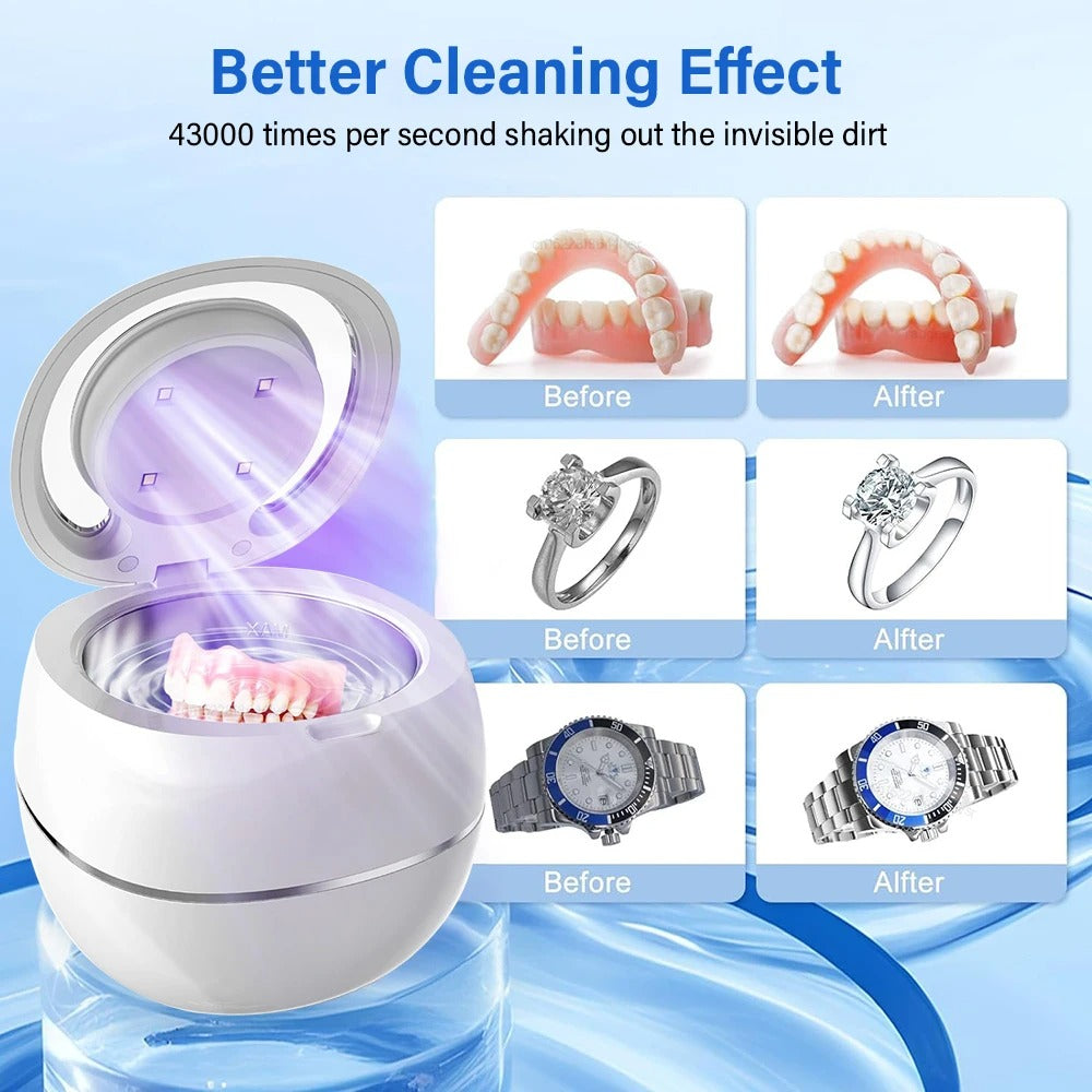 Ultrasonic Retainer Cleaner (2026 Edition)